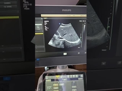 ATL CX50 EPIQ curved original ultrasound probe C5-1
